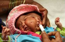 武漢剛出人魚胎兒 安