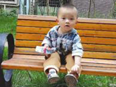 2歲男孩掉進湯鍋重度燙傷