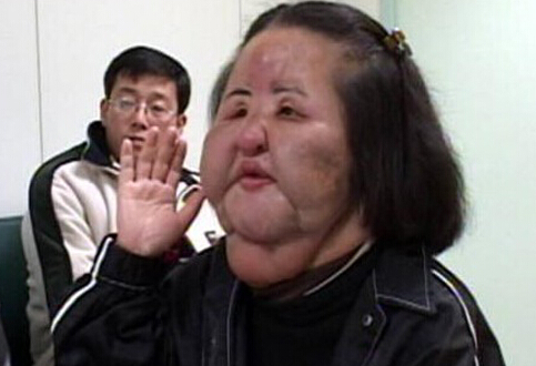 韓國電風(fēng)扇大媽整容失敗不忍直視