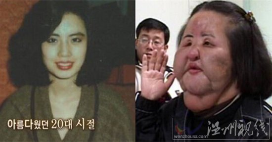 韓國電風(fēng)扇大媽整容失敗