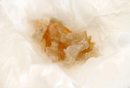 瑞安出現注膠蝦