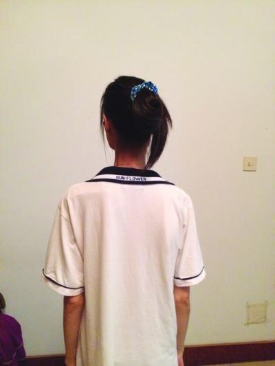 蘇州女孩減肥失控瘦成衣架