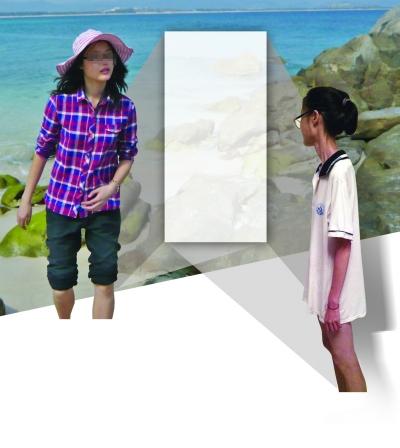 蘇州女孩減肥失控瘦成衣架