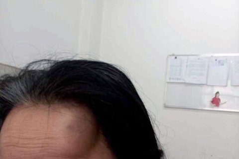 業(yè)主被跟蹤毆打