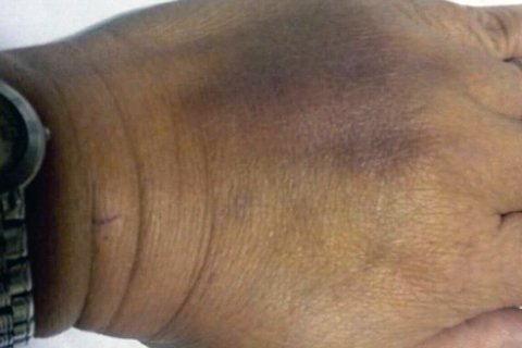 業(yè)主被跟蹤毆打