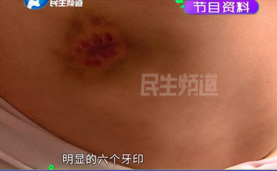 安陽王新剛被停職 河南安陽惡犬咬人王新剛狗仗人勢