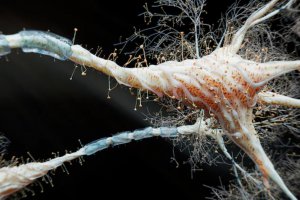 科學家發(fā)現(xiàn)治療帕金